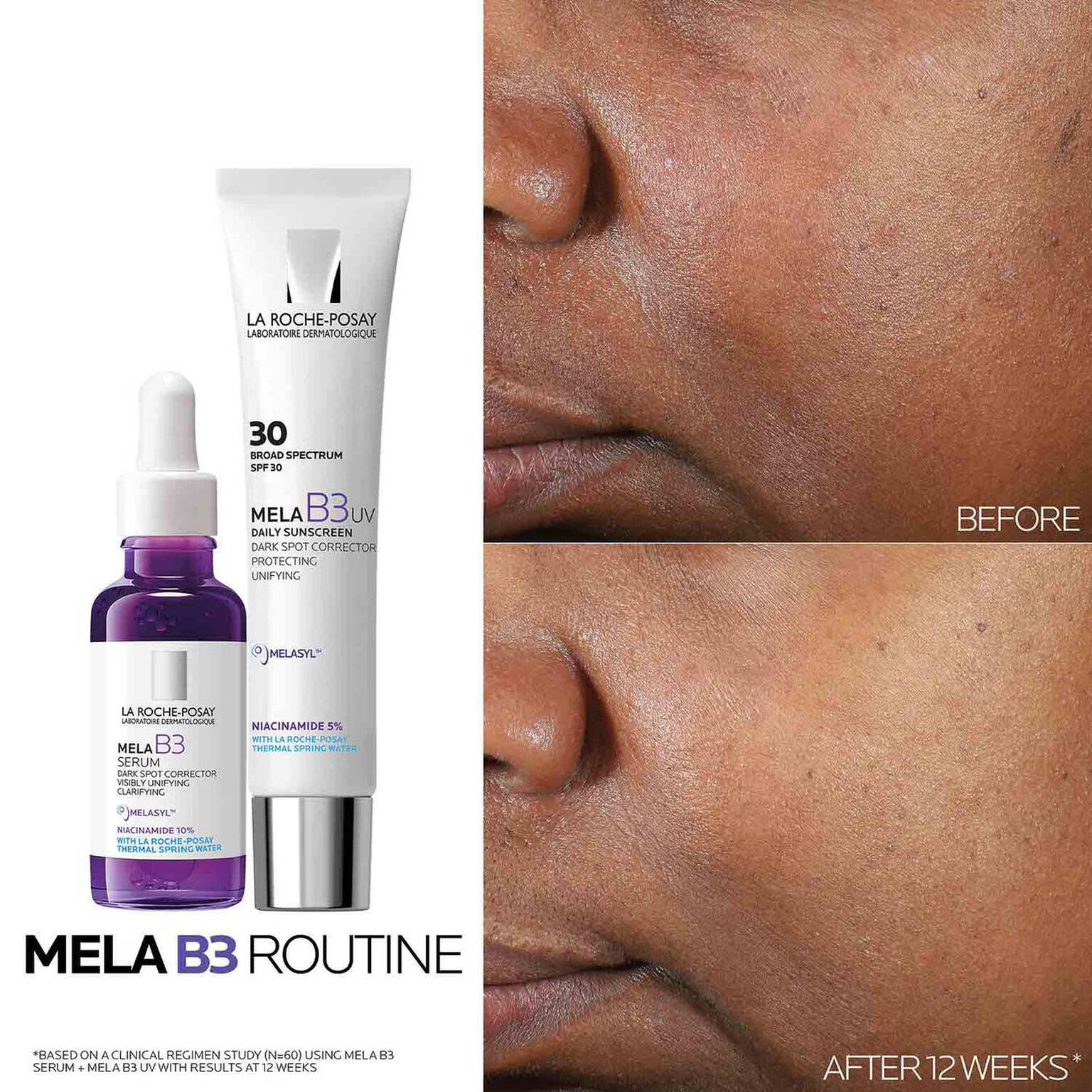 mela-b3-dark-spot-serum-and-mela-b3-uv-daily-moisturizer-with-spf-30-o4 3-Mela-B3-routine_1500X1500.jpg