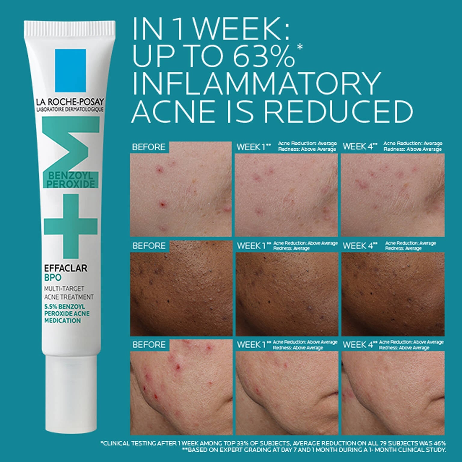 effaclar-bpo-multi-target-acne-treatment-with-5-5-benzoyl-peroxide-r3 EffaclarBPO-ClinicalBA-ATF-1500x1500-2.jpg