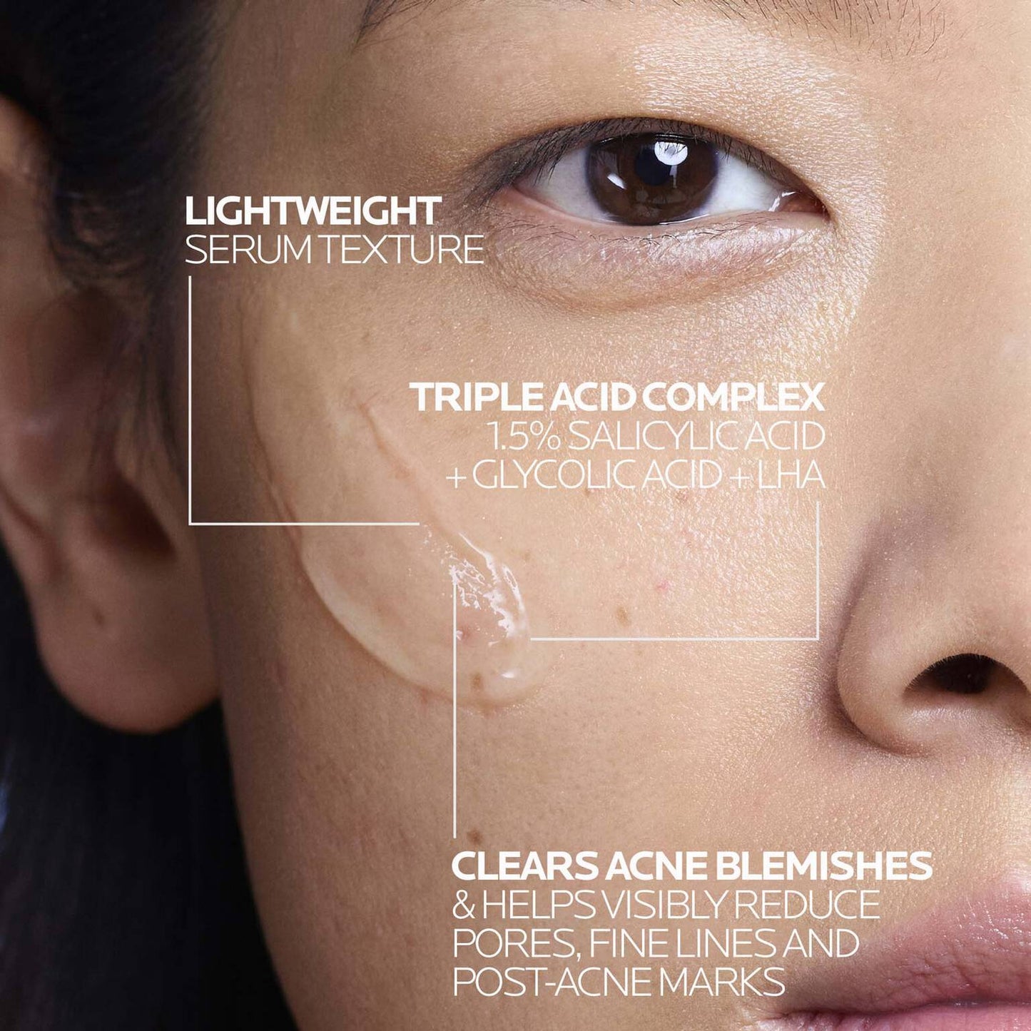 effaclar-salicylic-acid-acne-treatment-serum-i2 LaRochePosay-Product-Effaclar-Effaclar-Serum-30ml-3337875722827-Texture-REV.jpg