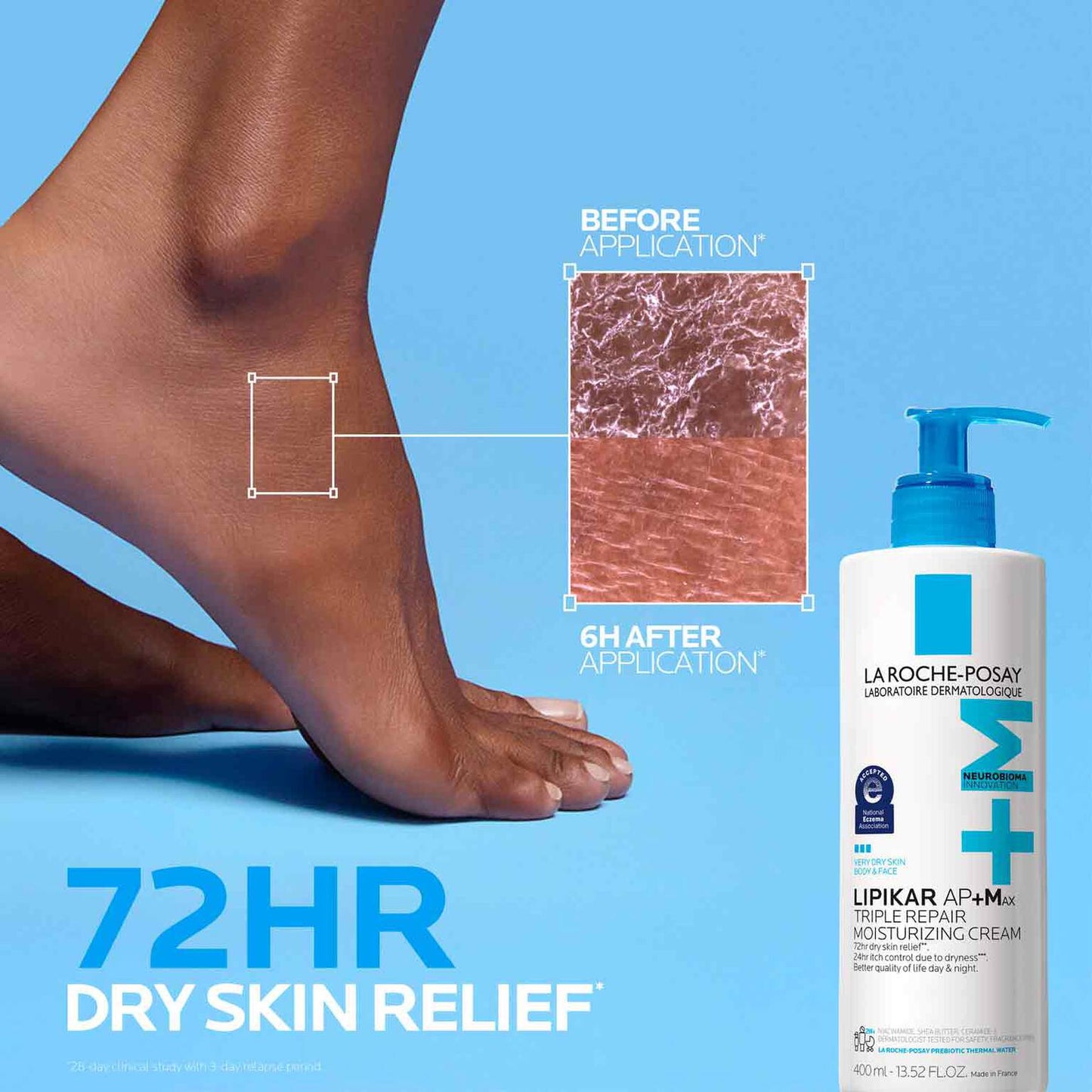 lipikar-ap-max-triple-repair-moisturizing-cream-y4 LaRochePosay-Product-Skincare-Lipikar-Balm-AP+MAX-400ml-3337875941150-ATF-PIM-BeforeAfter.jpg