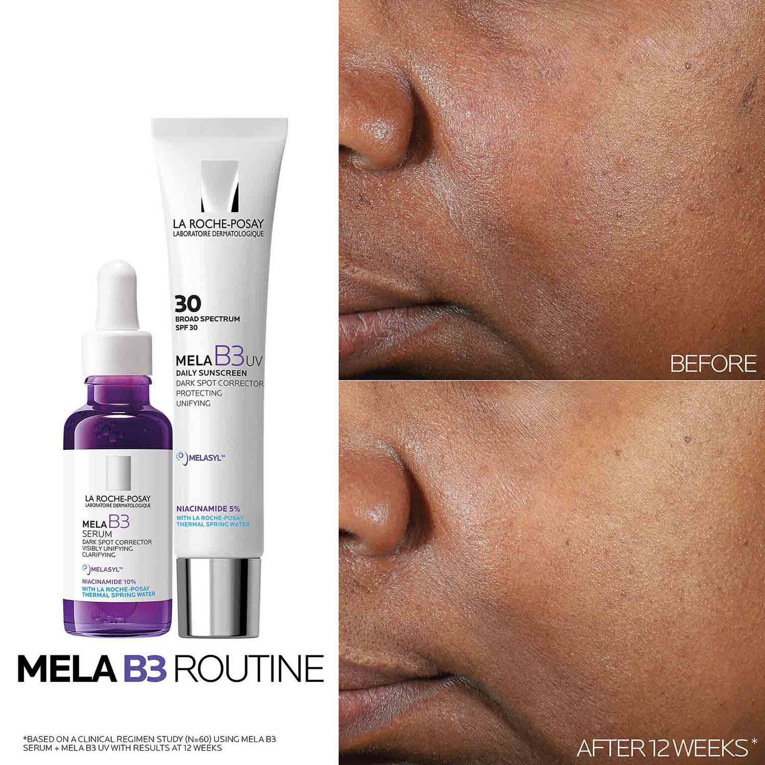 mela-b3-dark-spot-serum-with-melasyltm-niacinamide-f6 Mela-B3-routine_1500X1500.jpg
